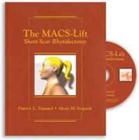 The MACS-Lift Short Scar Rhytidectomy