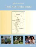 Your Guide to Total Hip Replacement