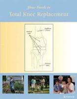 Your Guide to Total Knee Replacement