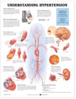 Understanding Hypertension Anatomical Chart
