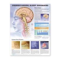 Understanding Sleep Disorders Anatomical Chart