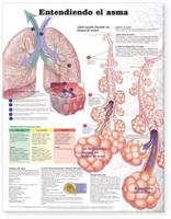 Understanding Asthma Anatomical Chart in Spanish (Entendiendo El Asma)