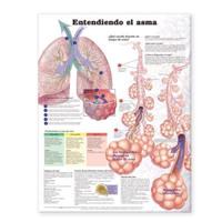 Understanding Asthma Anatomical Chart in Spanish (Entendiendo El Asma)