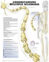 Understanding Multiple Sclerosis Anatomical Chart