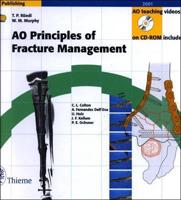 Ao Principles of Fracture Management