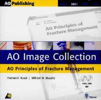 Ao Image Collection Ao Principles Of Fracture Management