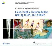 Elastic Stable Intramedullary Nailing (ESIN) in Children [With DVD]
