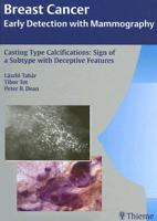 Casting Type Calcifications