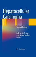 Hepatocellular Carcinoma