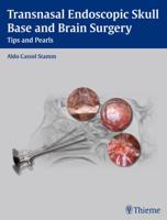 Transasal Endoscopic Skull Base and Brain Surgery