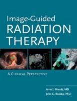 Image-Guided Radiation Therapy