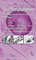 Liver Transplantation : Challenging Controversies and Topics