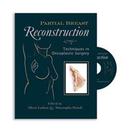 Partial Breast Reconstruction: Techniques in Oncoplastic Surgery