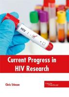 Current Progress in HIV Research