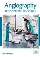 Angiography: Interventional Radiology