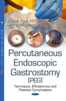 Percutaneous Endoscopic Gastrostomy (PEG)