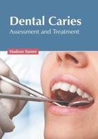 Dental Caries: Assessment and Treatment
