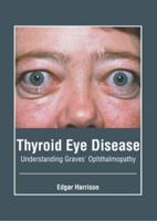 Thyroid Eye Disease: Understanding Graves' Ophthalmopathy