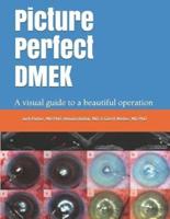 Picture Perfect DMEK