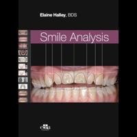 Smile Analysis