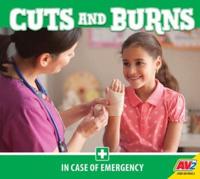 Cuts and Burns