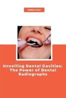 Unveiling Dental Cavities