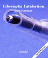 Fibreoptic Intubation