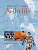 The Facts About Arthritis