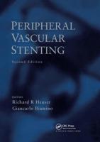 Peripheral Vascular Stenting