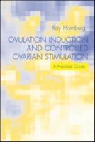 Ovulation Induction and Controlled Ovarian Stimulation