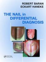The Nail in Differential Diagnosis