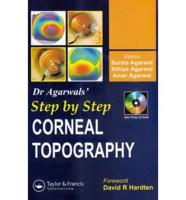 Step by Step Corneal Topography
