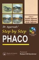 Step by Step Phaco
