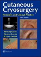 Cutaneous Cryosurgery