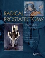 Radical Prostatectomy