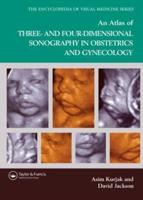 An Atlas of Three- And Four-Dimensional Sonography in Obstetrics and Gynecology