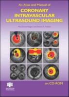 An Atlas and Manual of Coronary Intravascular Ultrasound Imaging