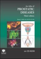 An Atlas of Prostatic Diseases CD-ROM