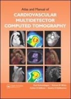 Atlas and Manual of Cardiovascular Multidetector Computed Technology