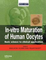 In-Vitro Maturation of Human Oocytes