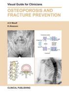 Osteoporosis and Fracture Prevention