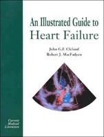 An Illustrated Guide to Heart Failure