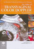 An Atlas of Transvaginal Color Doppler