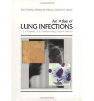 An Atlas of Lung Infections