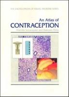 A Slide Atlas of Contraception