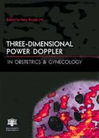 Three-Dimensional Power Doppler in Obstetrics & Gynecology