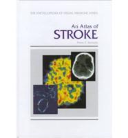 An Atlas of Stroke