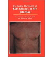 Illustrated Handbook of Skin Disease in HIV Infection