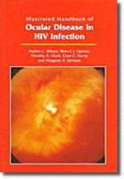 Illustrated Handbook of Ocular Disease in HIV Infection