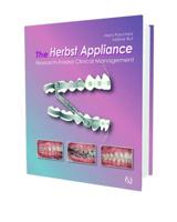 The Herbst Appliance